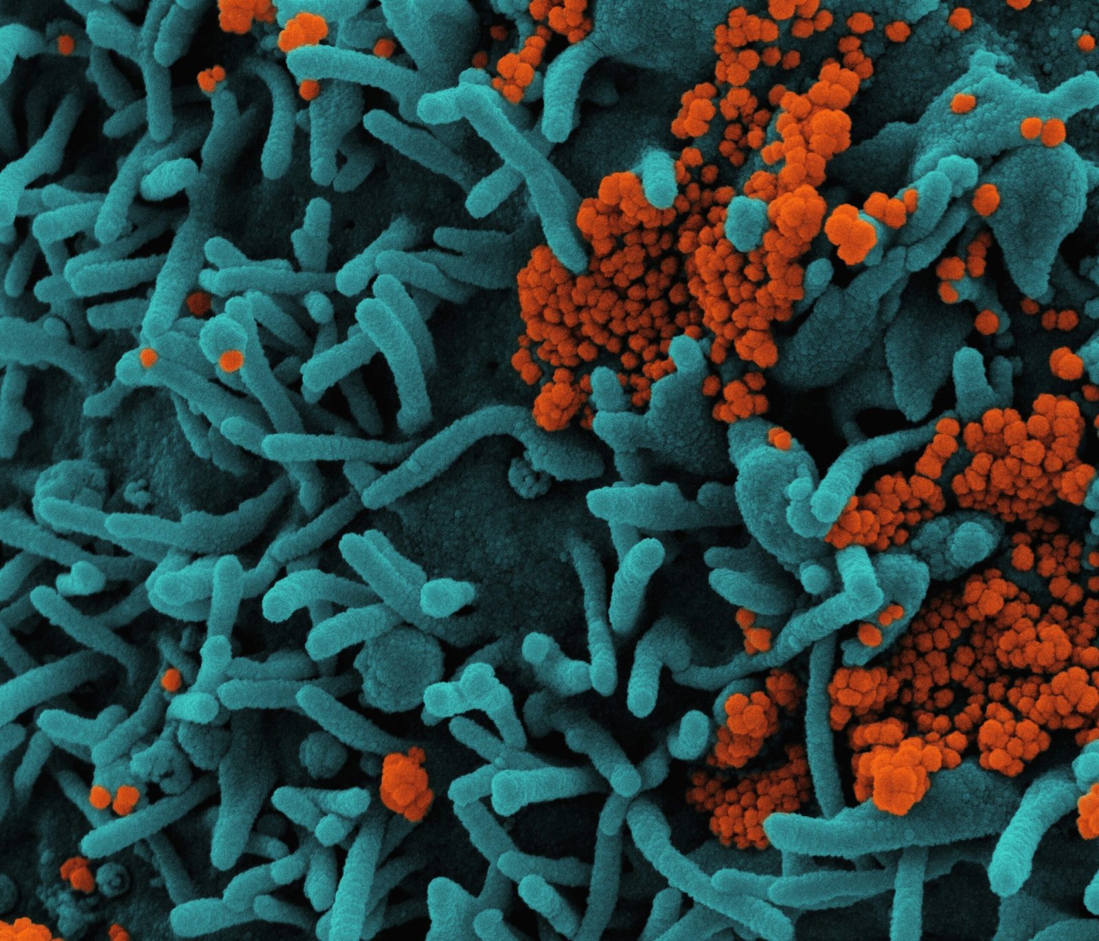 national-institute-of-allergy-and-infectious-diseases-nC6ZdM-WeCY-unsplash
